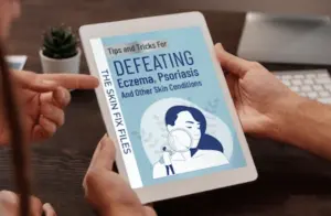 The Skin Fix Files Tips and Tricks for Defeating Eczema, Psoriasis And Other Skin Conditions