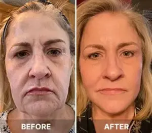 south beach Skin Customer reviews